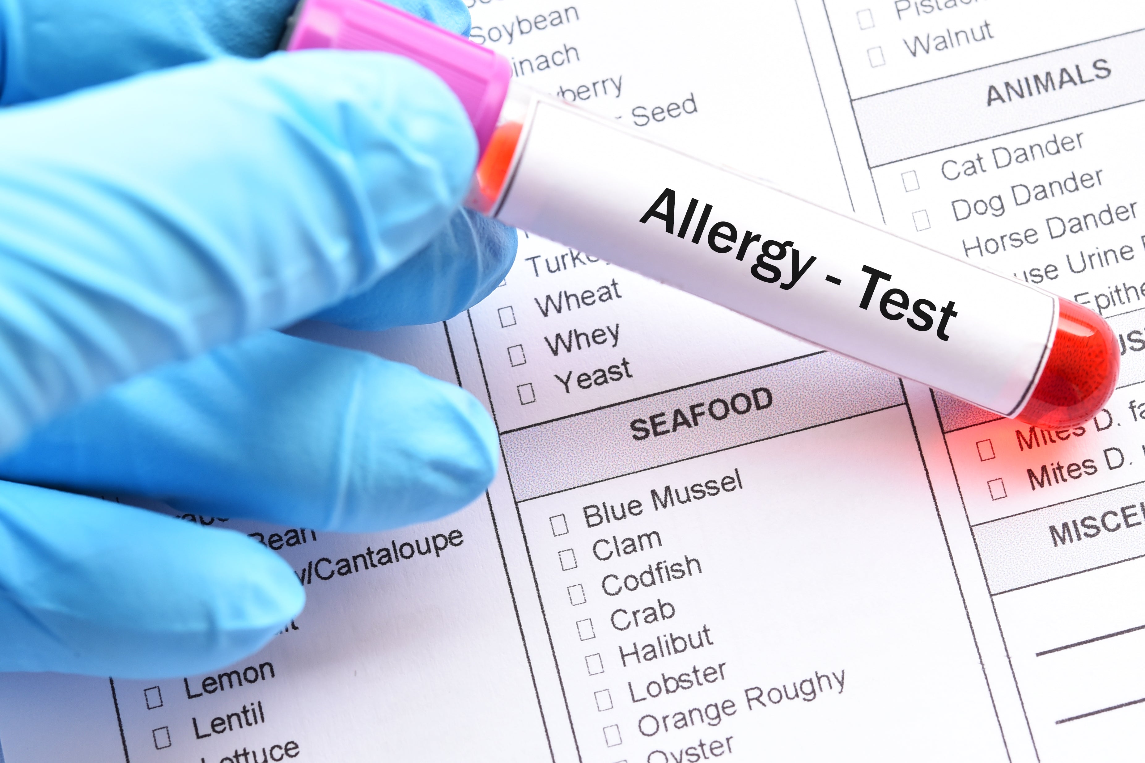 How Much Does an Allergy Test Cost?